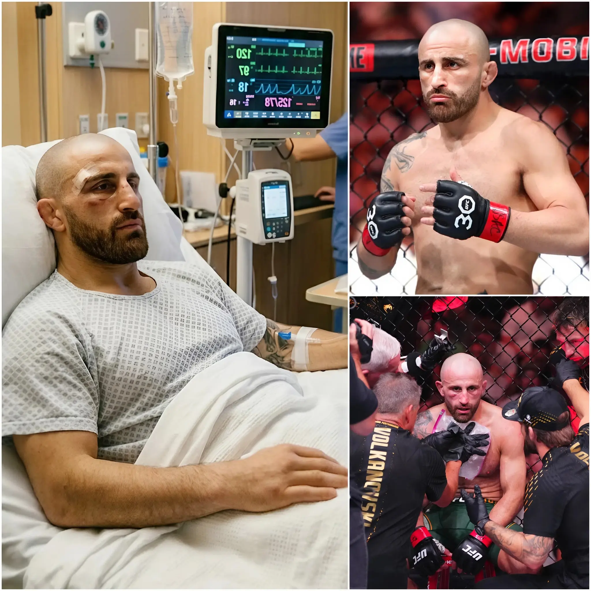 Cover Image for 🚨SHOCKING NEWS: Alexander Volkanovski has sent shockwaves through the MMA world after announcing he will temporarily step away from competition following UFC 325, declaring, “I need to listen to my body right now!” The Australian superstar revealed that he will dedicate all his time to recovering from a shoulder injury sustained during the epic battle at UFC 325. Volkanovski’s entire family, from his parents to his siblings, fully support this decision and emphasized that his health is the top priority at this moment, especially after he gave absolutely everything in one of the most grueling performances of his career.
