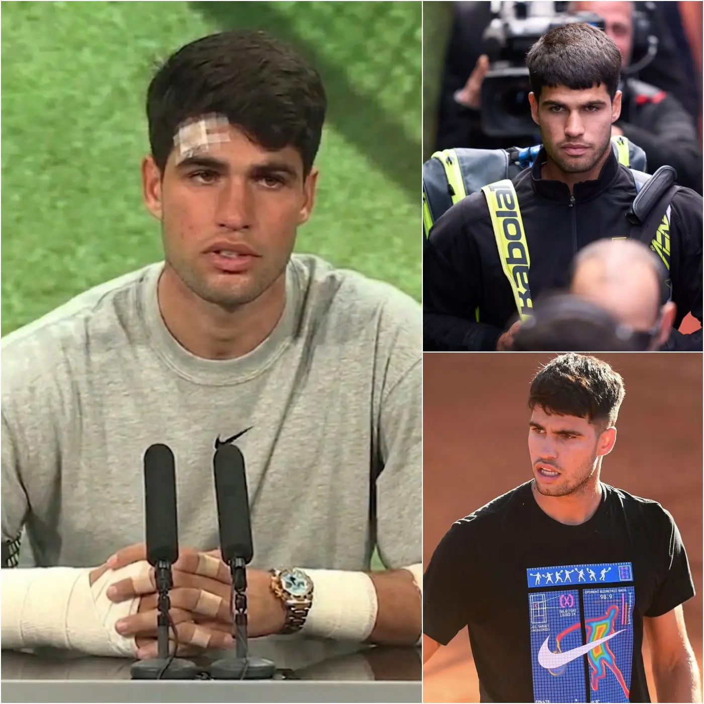 Cover Image for 🚨 BREAKING NEWS: Carlos Alcaraz officially speaks out after wrist surgery — and his words are leaving the tennis world speechless with emotion 🎾