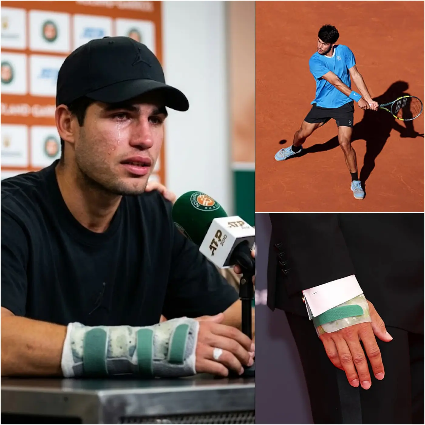 Cover Image for 💔 Carlos Alcaraz appeared with his wrist splinted just before Roland Garros. Gone was his usual energetic self; Alcaraz quietly admitted his disappointment in himself. He couldn’t hide his anxiety at the thought of potentially disappointing those who believed in him. “There are times… I wonder if I’ve done enough,”
