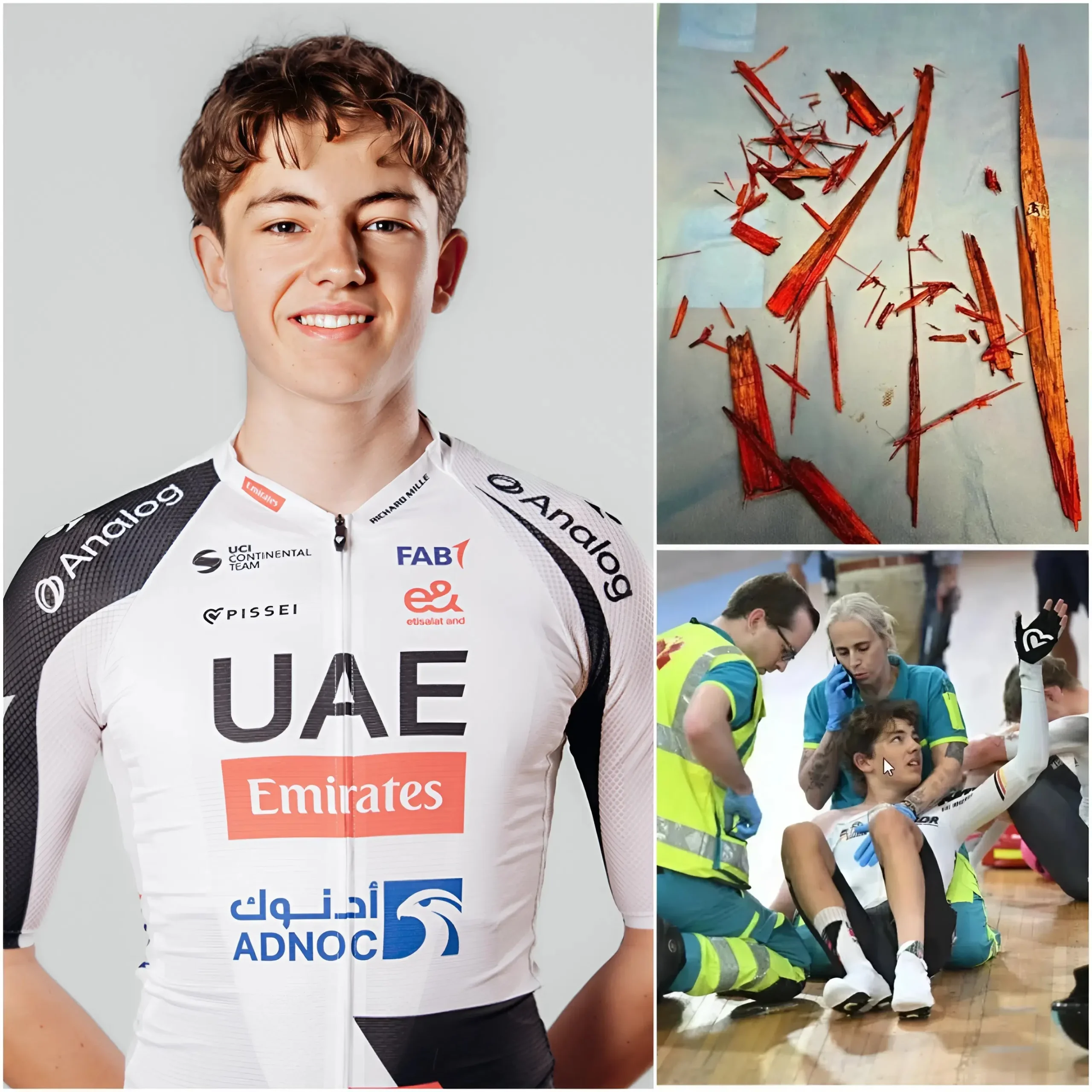 Cover Image for 🚨 Cyclist Moritz Mauss Undergoes Emergency Surgery After 50cm Wooden Stake Impalement in Track Accident