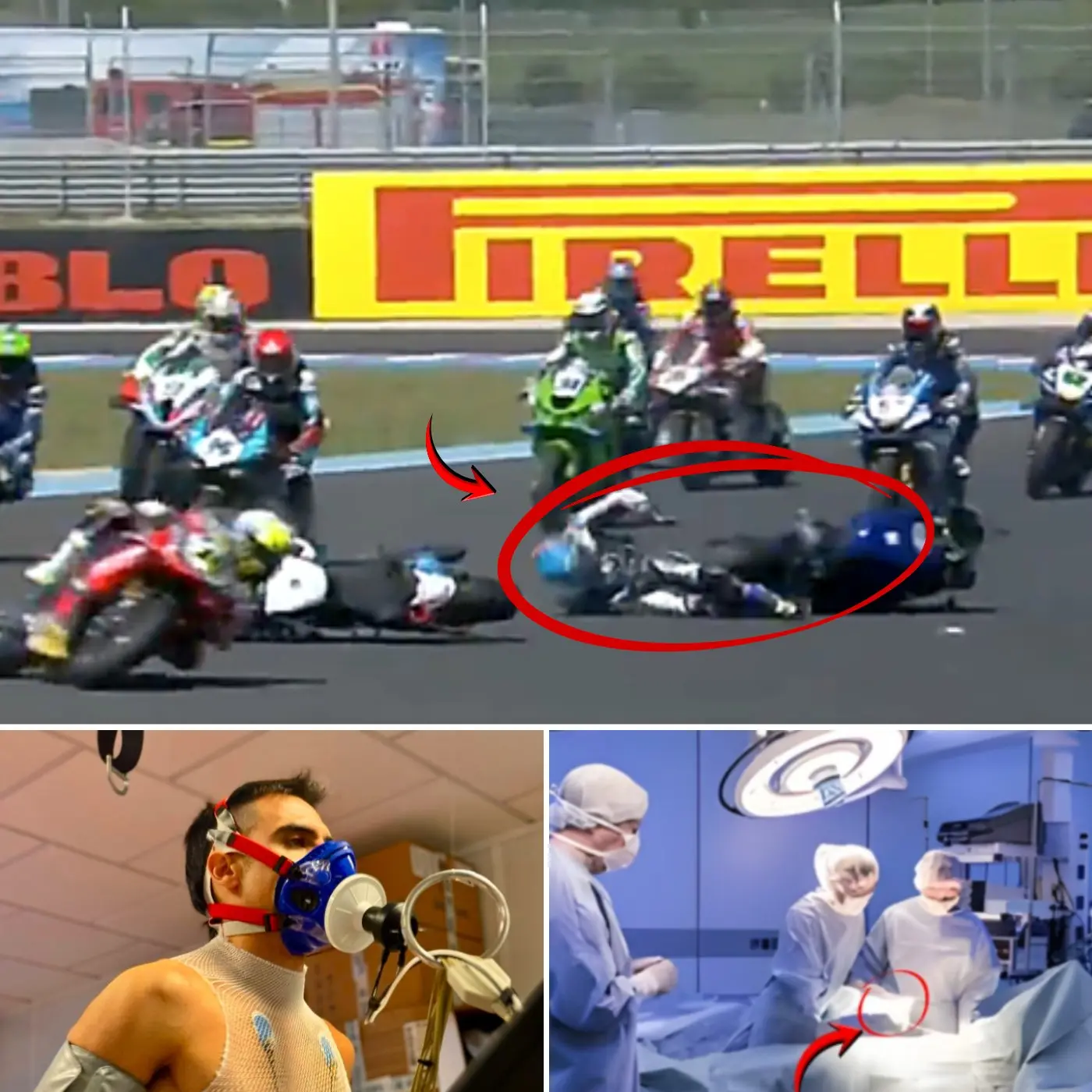 Cover Image for 😲🚨LE VOILE FINAL EST LIBÉRÉ : L’équipe médicale ROKiT BMW a enfin révélé la vérité sur la blessure de Miguel Oliveira ; les derniers résultats de l’IRM ont laissé les fans sans voix. 👇👇👇