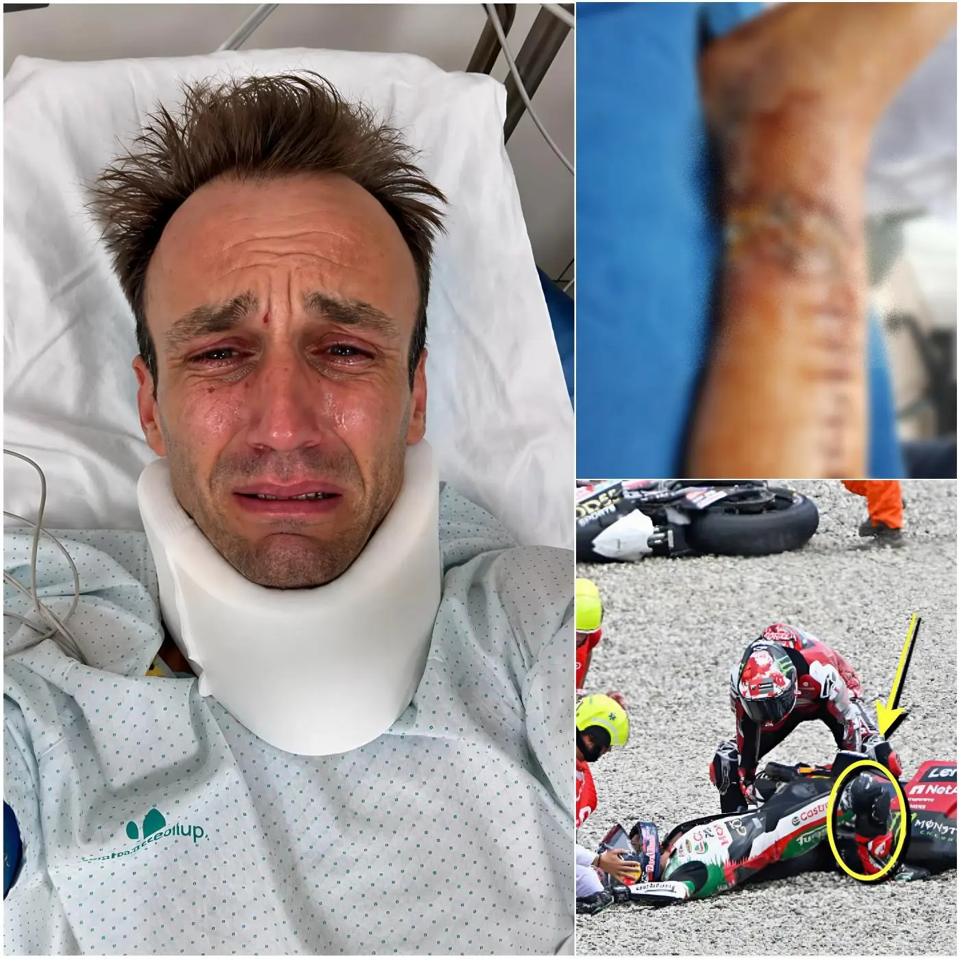 Cover Image for 🥲💔 NOUVELLE DÉCHIRANTE : « Je suis désolé… Je ne peux plus continuer » – Après un terrible accident, Johann Zarco, en larmes, a annoncé sa retraite. Une grave blessure à la jambe le fait courir le risque d’avoir de plus grandes difficultés à marcher et pourrait ne plus être autorisé à revenir à la compétition moto.