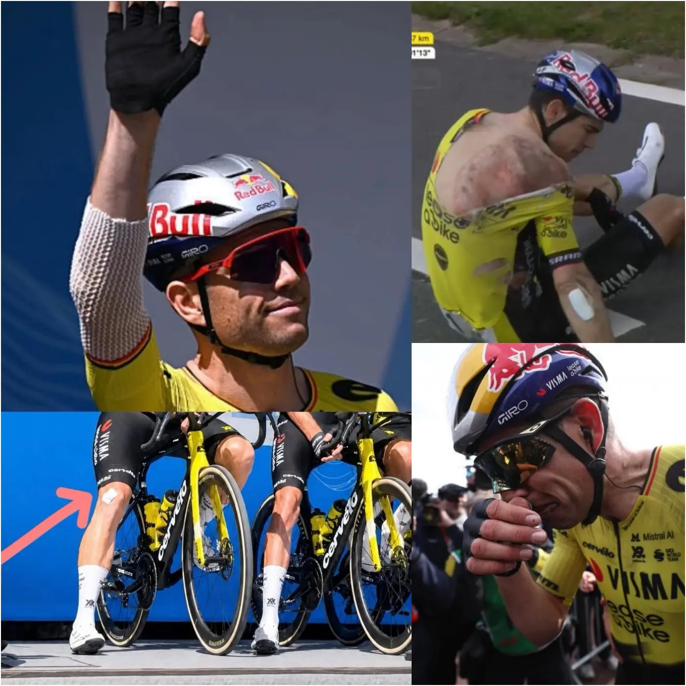 Cover Image for “SOMETHING HAPPENED BEHIND THE SCENES…” — WOUT VAN AERT ARRIVED WITH VISIBLE INJURIES, BUT THAT WASN’T WHAT TRULY CAUGHT EVERYONE’S ATTENTION